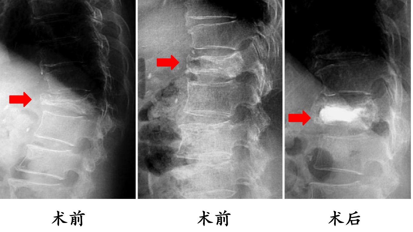 术前术后图片.jpg